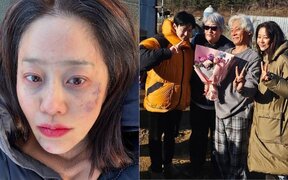 Go Hyun Jung Shocks Fans With Bruised Face After Finishing "The Mantis: Original Sin" Filming: "I just want to sleep"