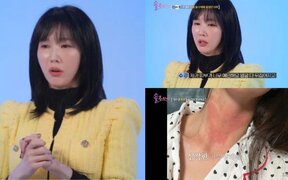 Actress Lee Soo Kyung Reveals She Almost Quit Acting due to a Mysterious Skin Condition