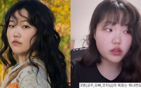 AKMU's Lee Suhyun opens up about 30kg weight loss and says “my life completely changed”