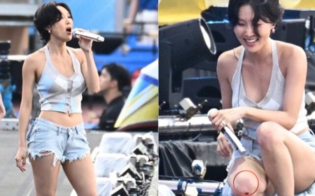 Hwasa shocks fans by finishing Psy’s Summer Swag stage despite bleeding knee injury during performance