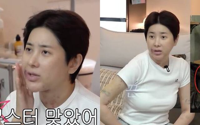 Seo In Young reveals she underwent arm liposuction for Waterbomb 2026 and says her father still does not know