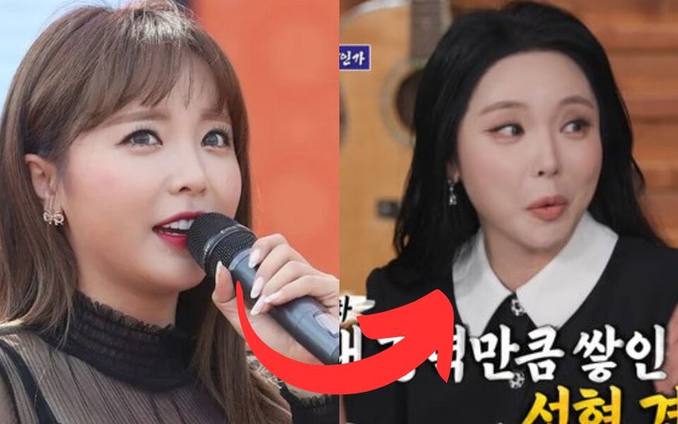 Image for Hong Jin Young Shocks Fans with a Different Face After Admitting to Three Plastic Surgeries—Even Gives Plastic Surgery Advice on TV