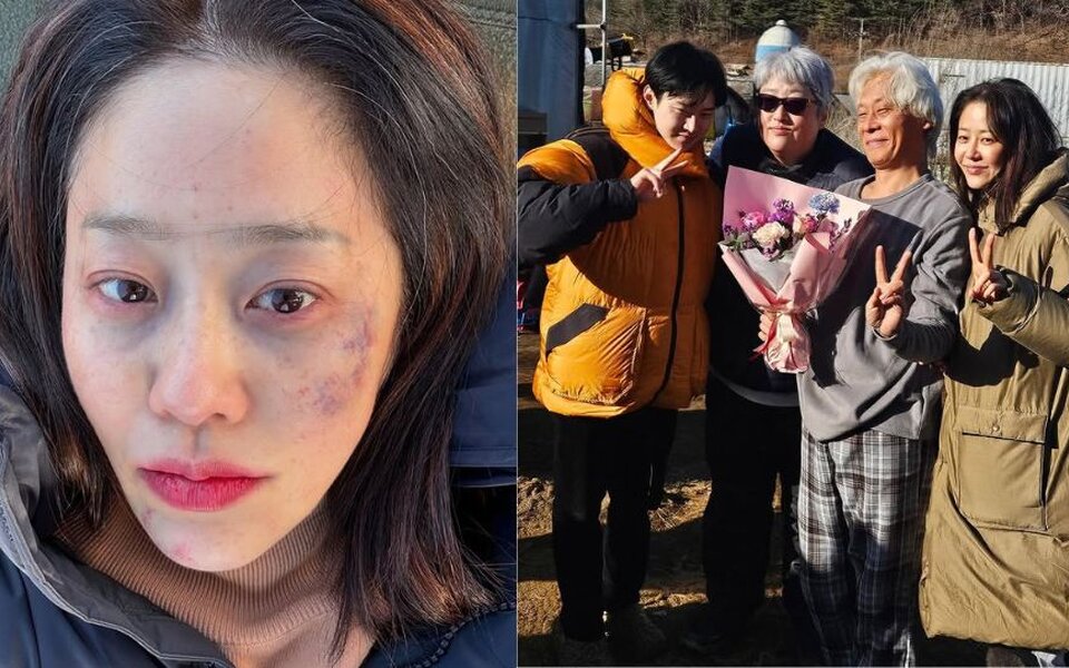 Image for Go Hyun Jung Shocks Fans With Bruised Face After Finishing "The Mantis: Original Sin" Filming: "I just want to sleep"