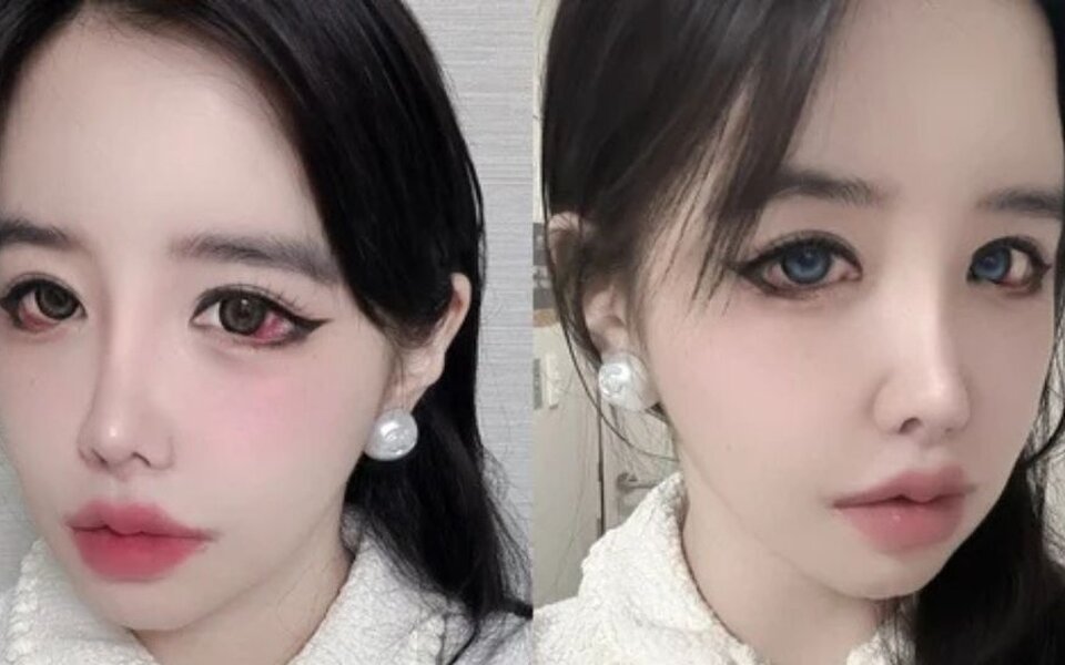 Image for Park Bom’s New Selfie Shocks Fans as Her Bloodshot Eyes Spark Major Health Concerns: "Unnie, Are You Okay?"