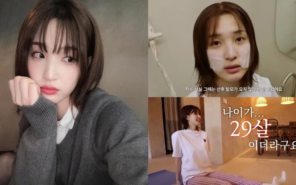 Image for Former LABOUM’s Yulhee Opens Up About Hair Loss From Stress — "I Still Feel Like I’m 20"
