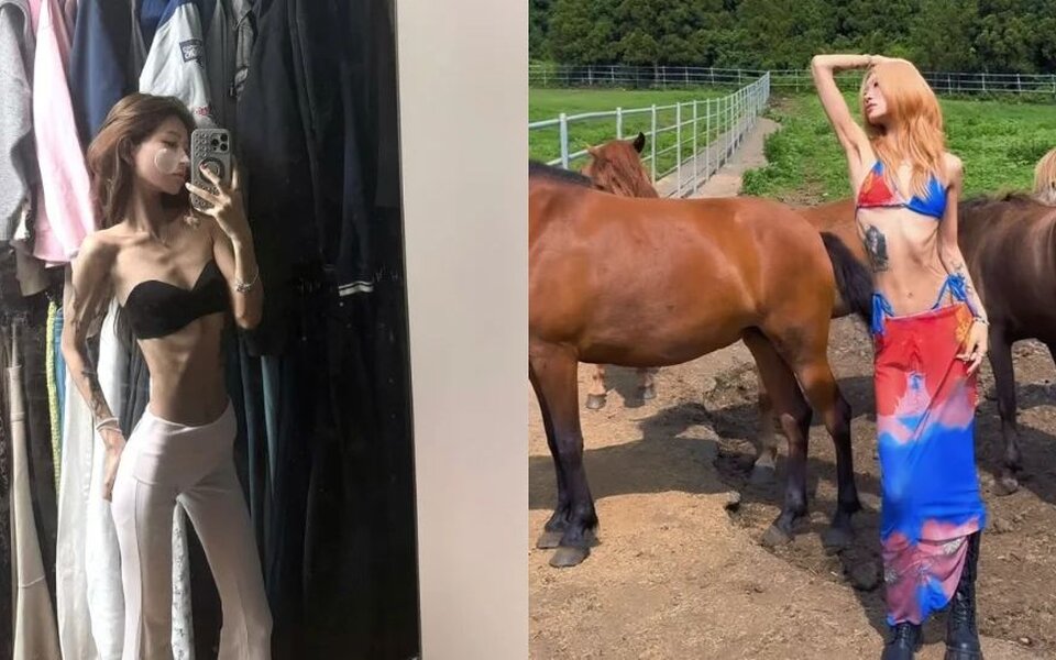 Image for Choi Jun Hee goes viral after revealing dramatic weight loss