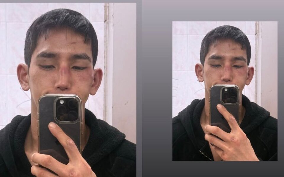 Image for Single’s Inferno 4 star Yoo Jun Seo says he needs surgery after nose fracture, eardrum rupture and elbow injury