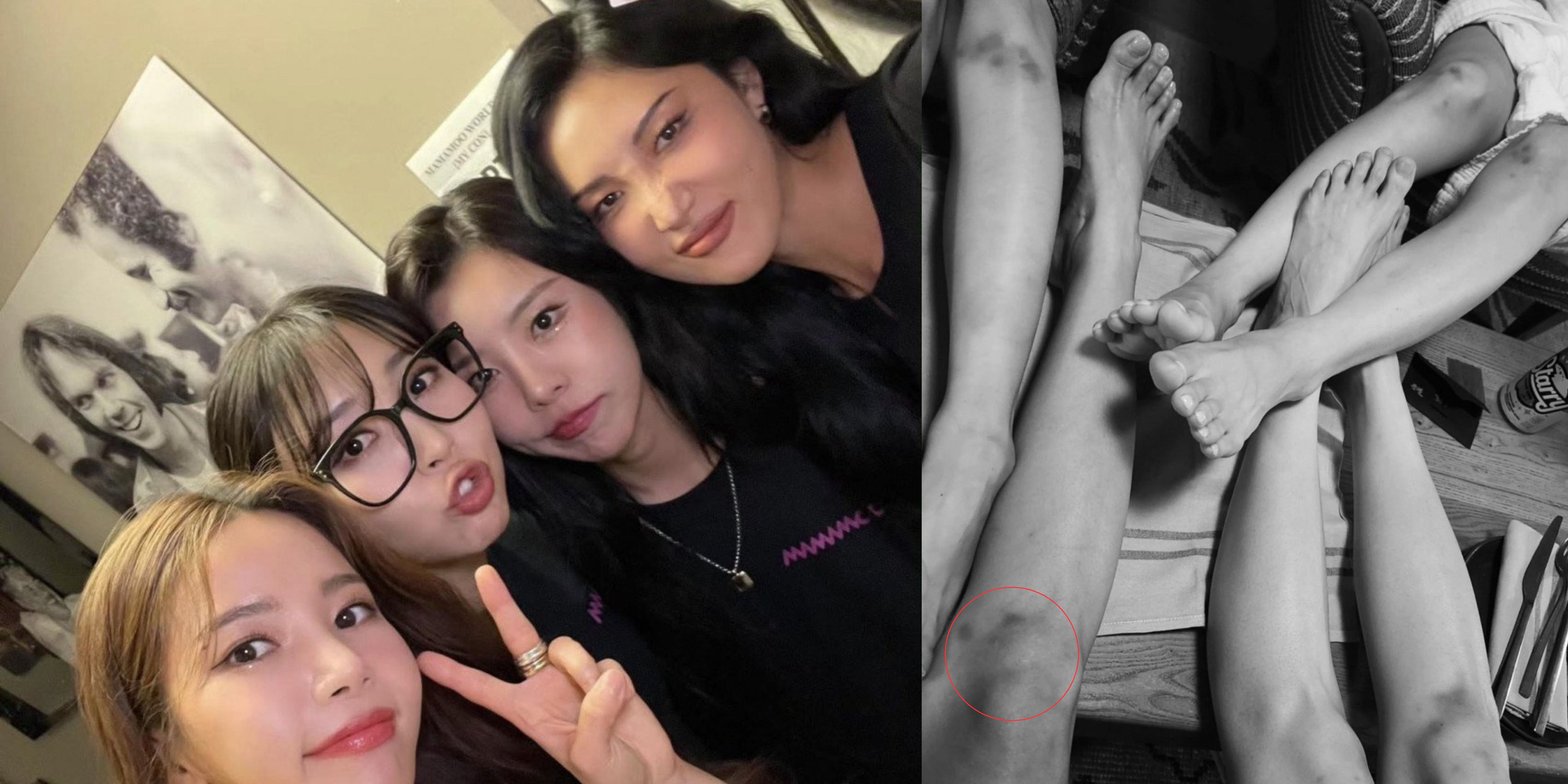 "OMG, they're hurt" Fans Show Appreciation as MAMAMOO's Hwasa Exposes the Sacrifices Made at LA Concert