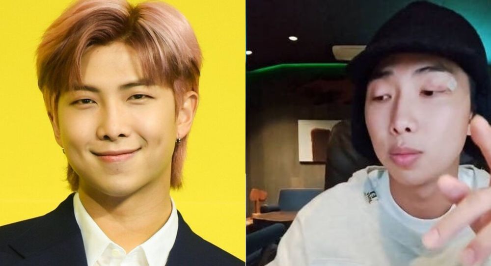 BTS RM shares news of eye injury, got 5 stitches while filming