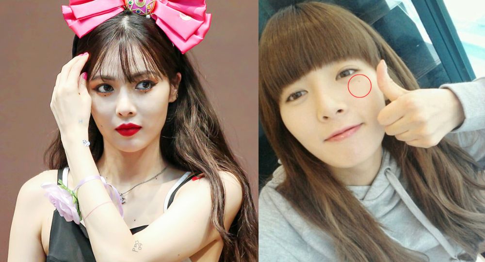 "I thought it was natural" — HyunA's mole sparks controversy among netizens