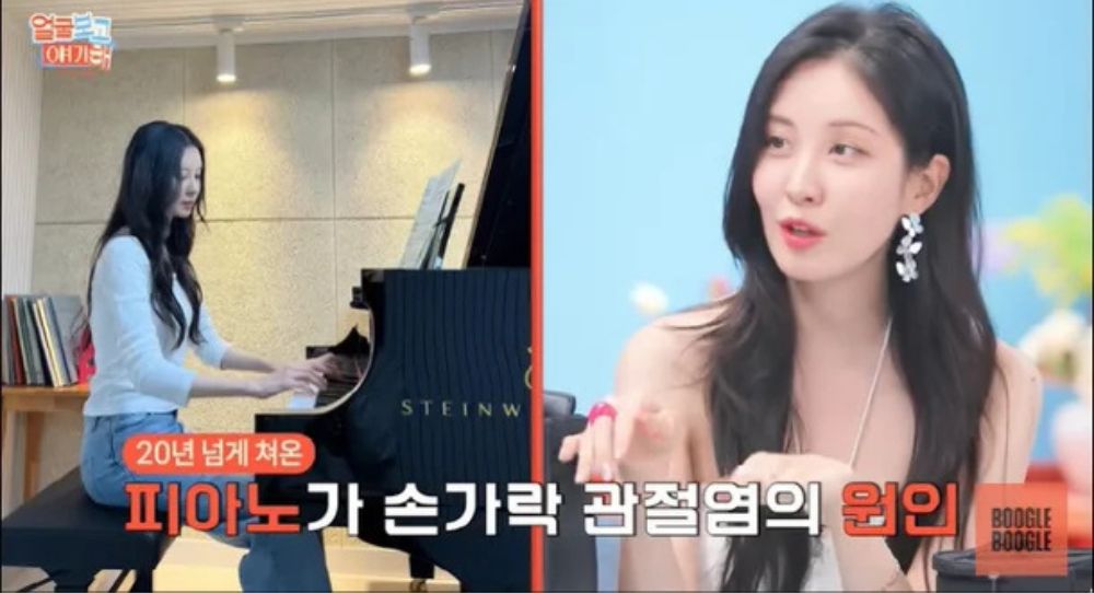 Girls' Generation's Seohyun reveals she got arthritis from piano - Here's Why