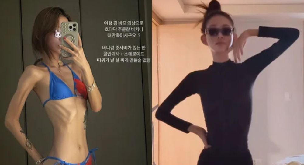 Choi Joon Hee shows off jaw-dropping bikini body after losing over 50kg
